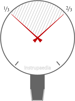 ideal readout range of a pressure gauge